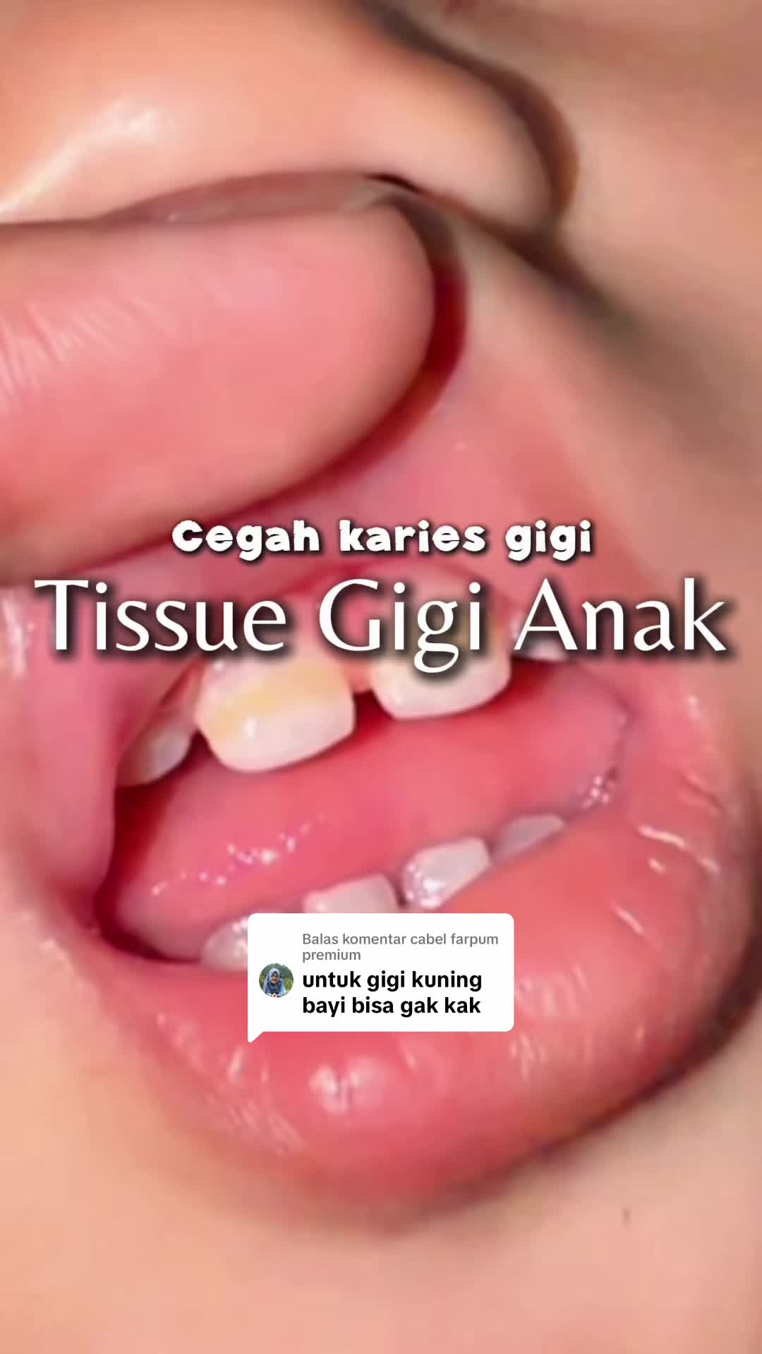 @Amihnya Keenan & Kafi