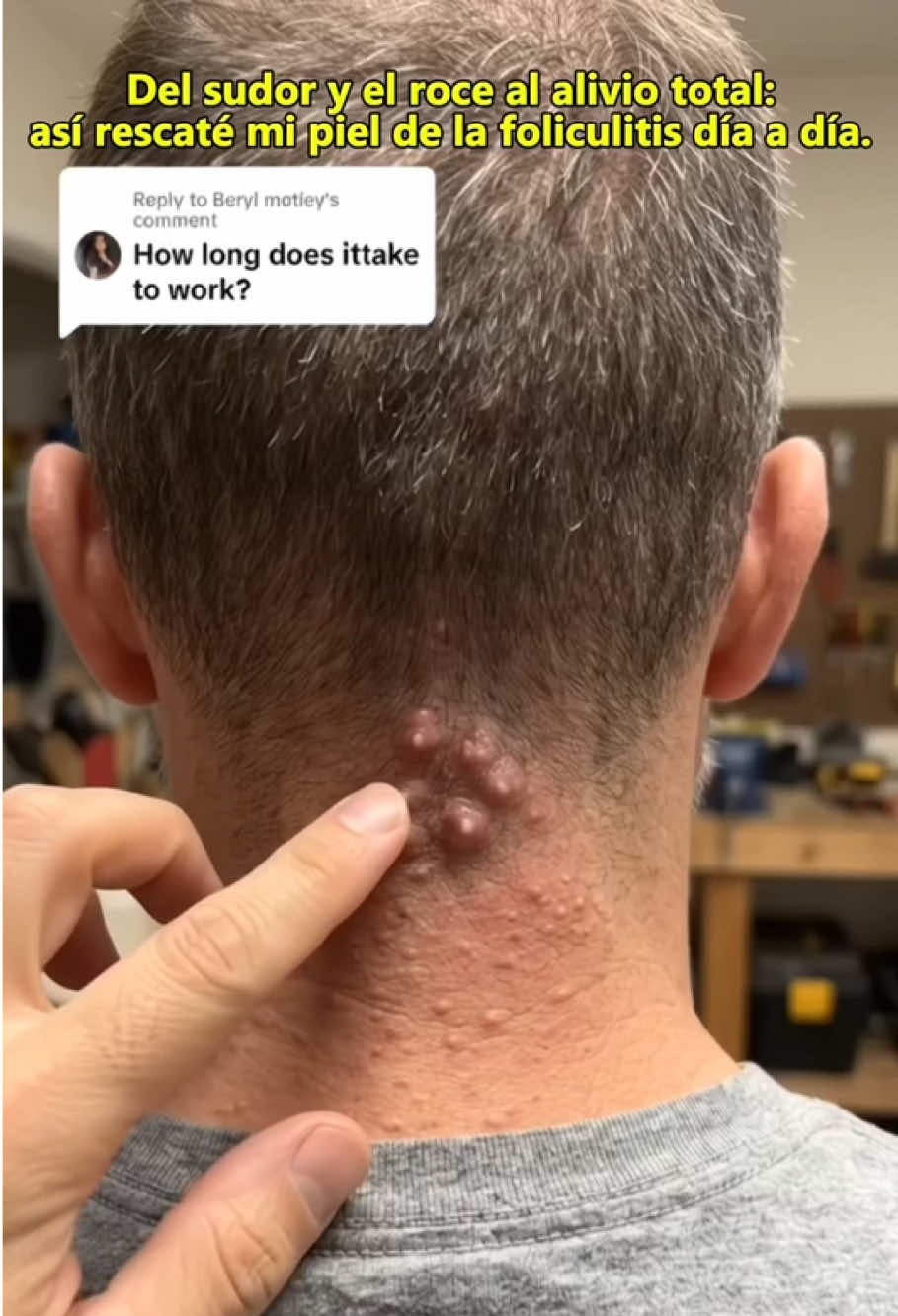 @CJMJIM.ScalpCare10