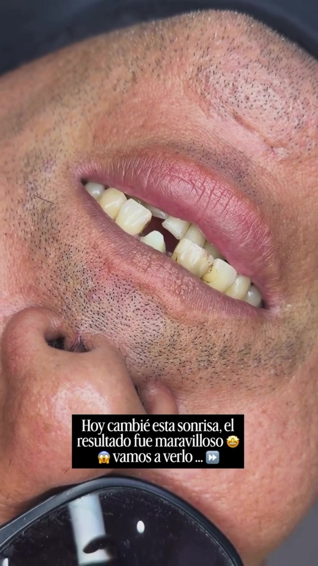 @Dralizbonilla