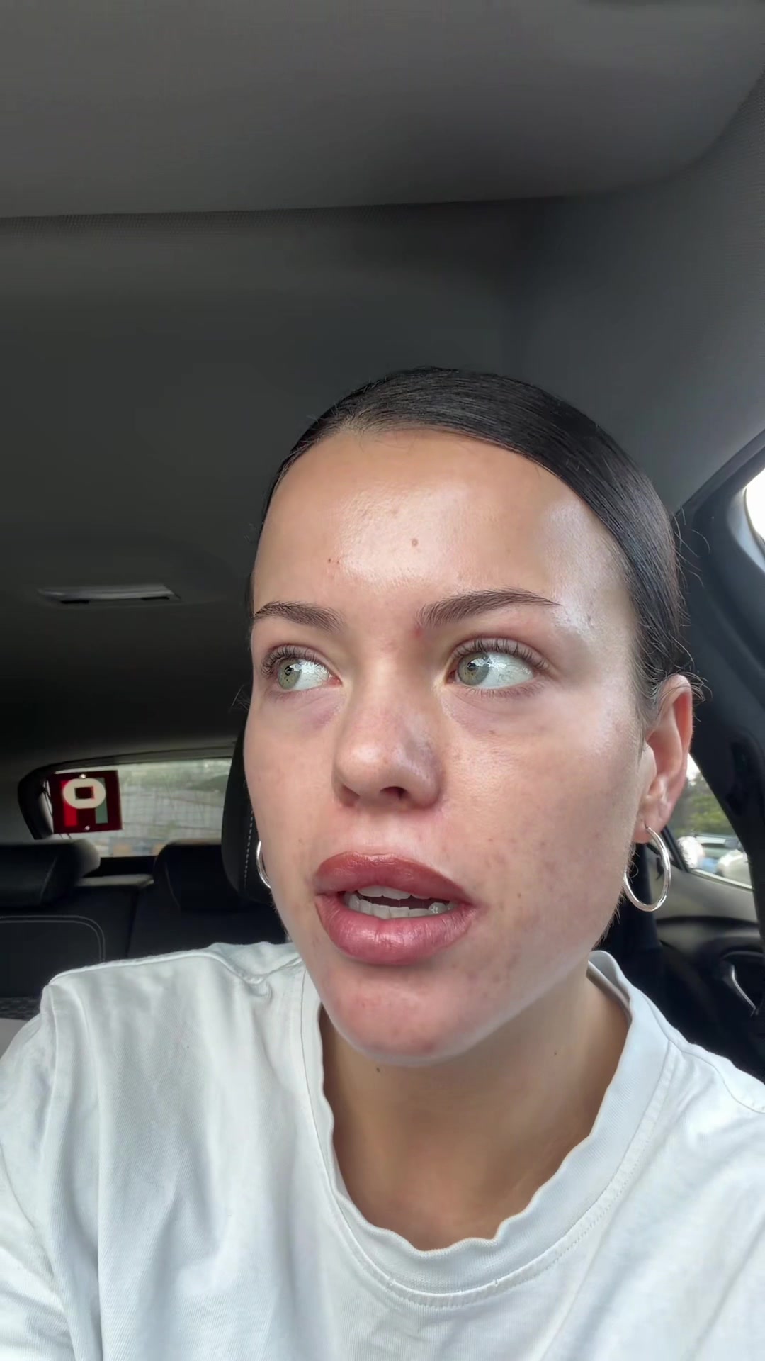 @suki