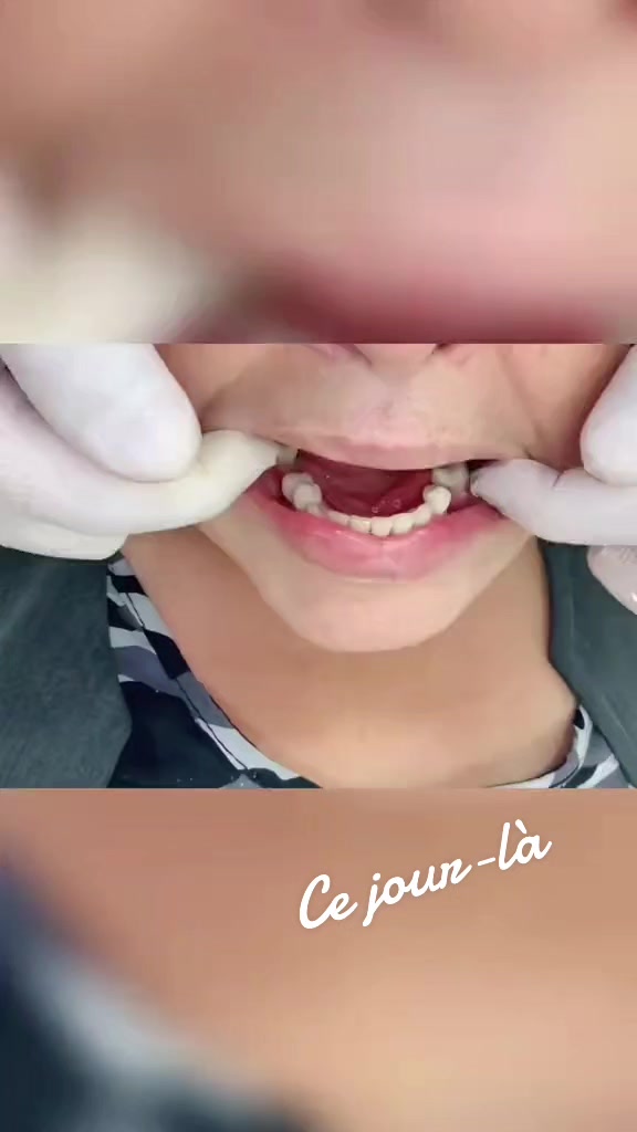 @Dr HASSOUN02 طبيبة الاسنان شلف