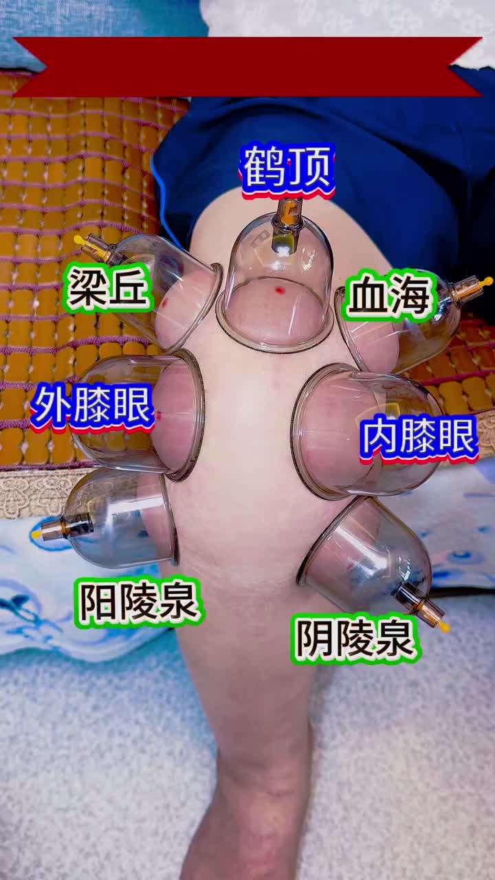 @穴位