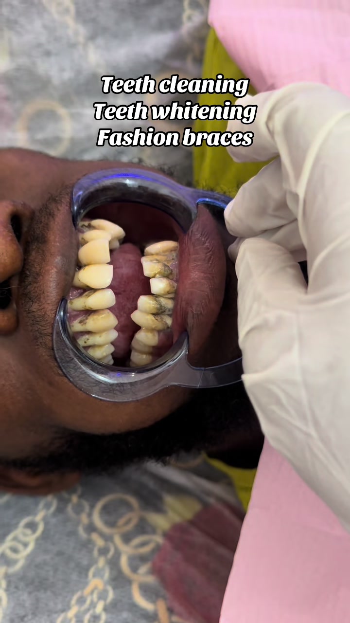 @Teethwhitening—MartGlow Avenue
