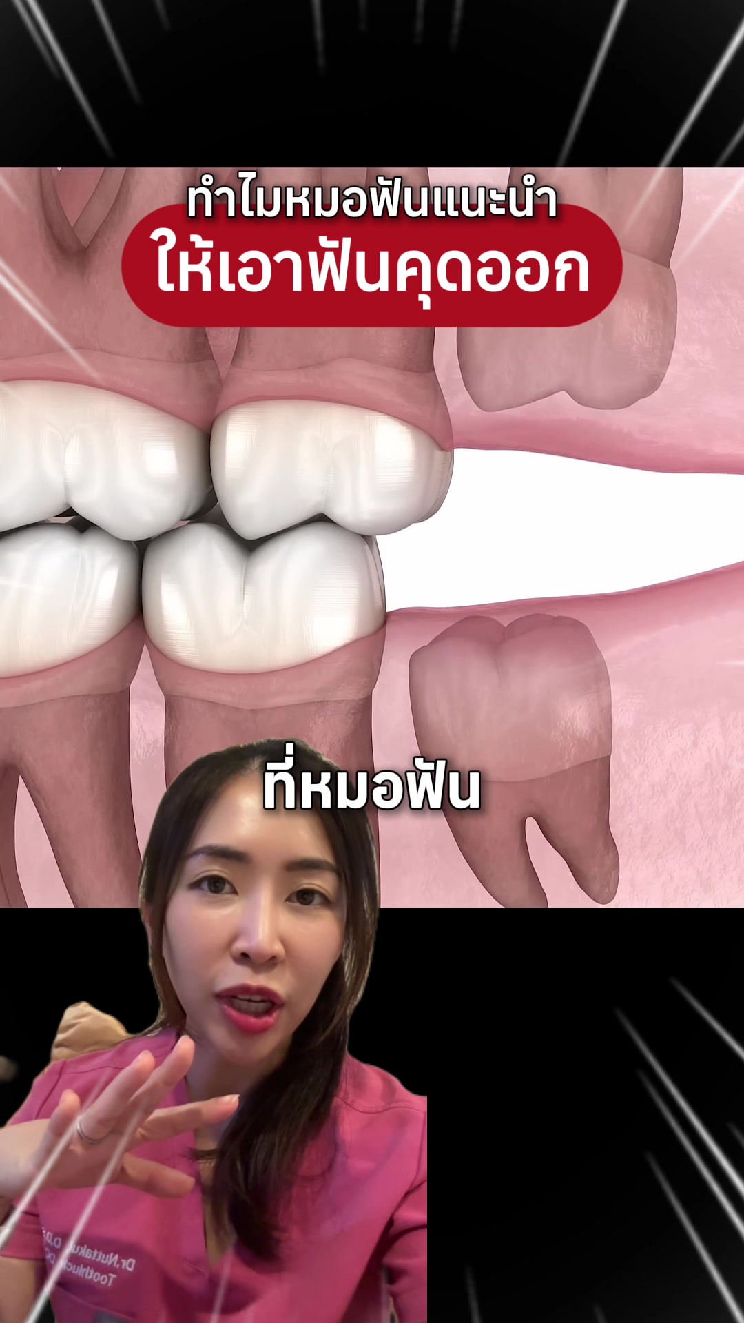 @ณัฐคุณ (Nuttakul Dent) 🦷