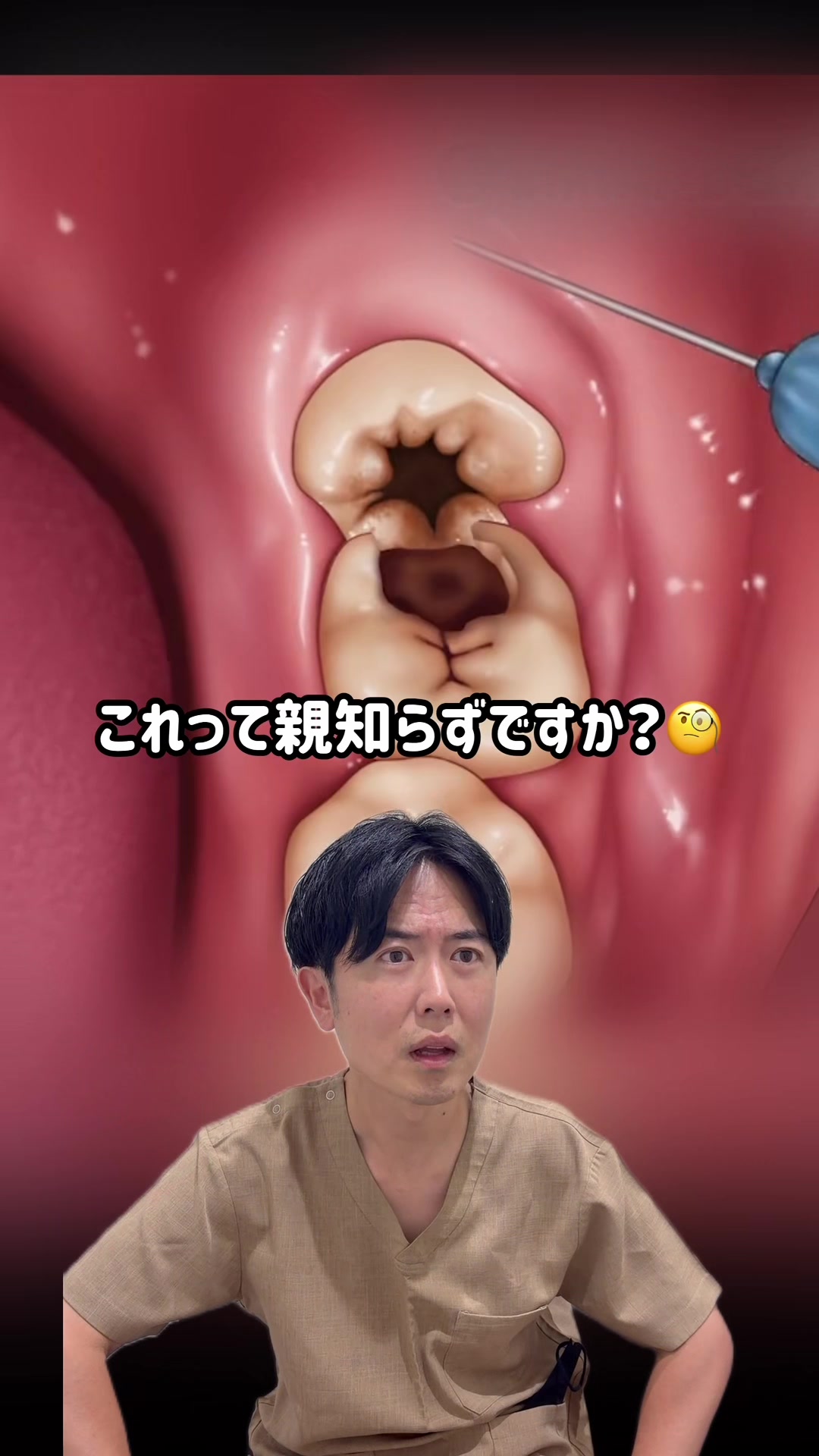 @Dr.山元(湘南歯科クリニック心斎橋院)