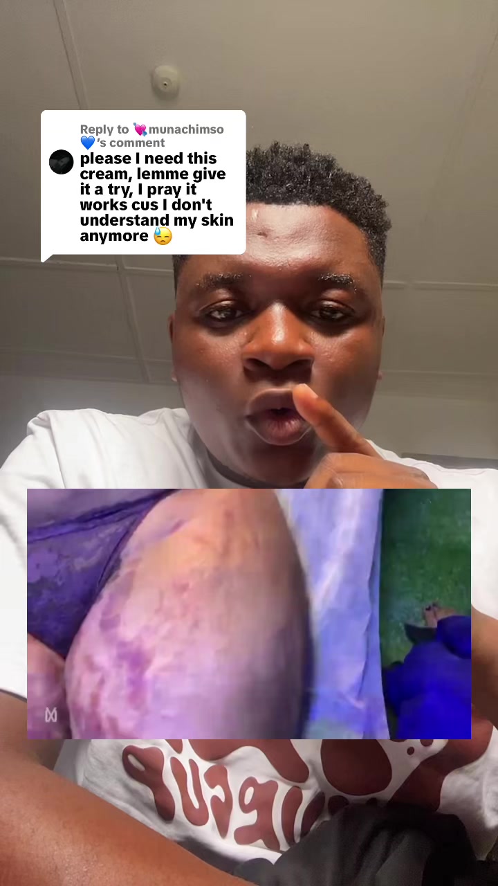 @Radiant skin