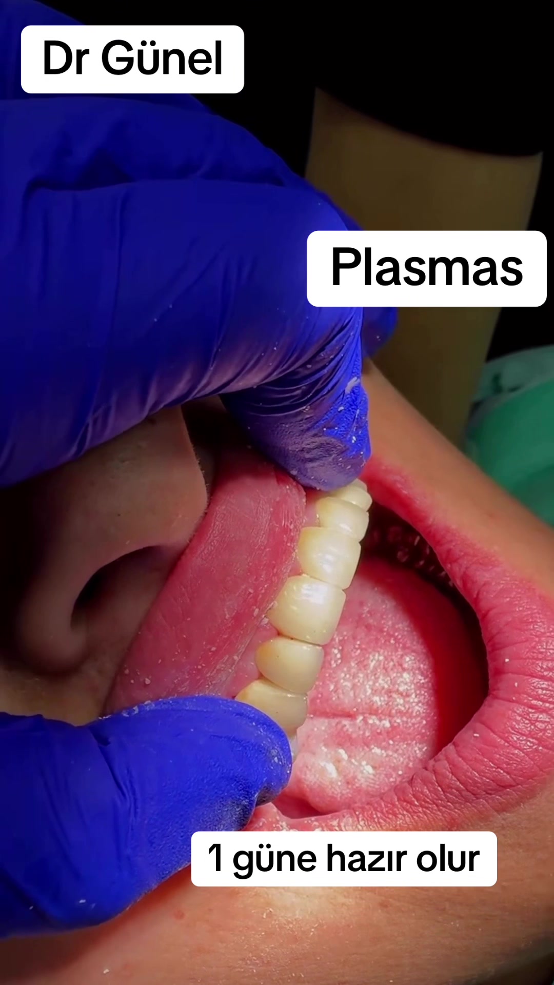 @Dentist_Günel