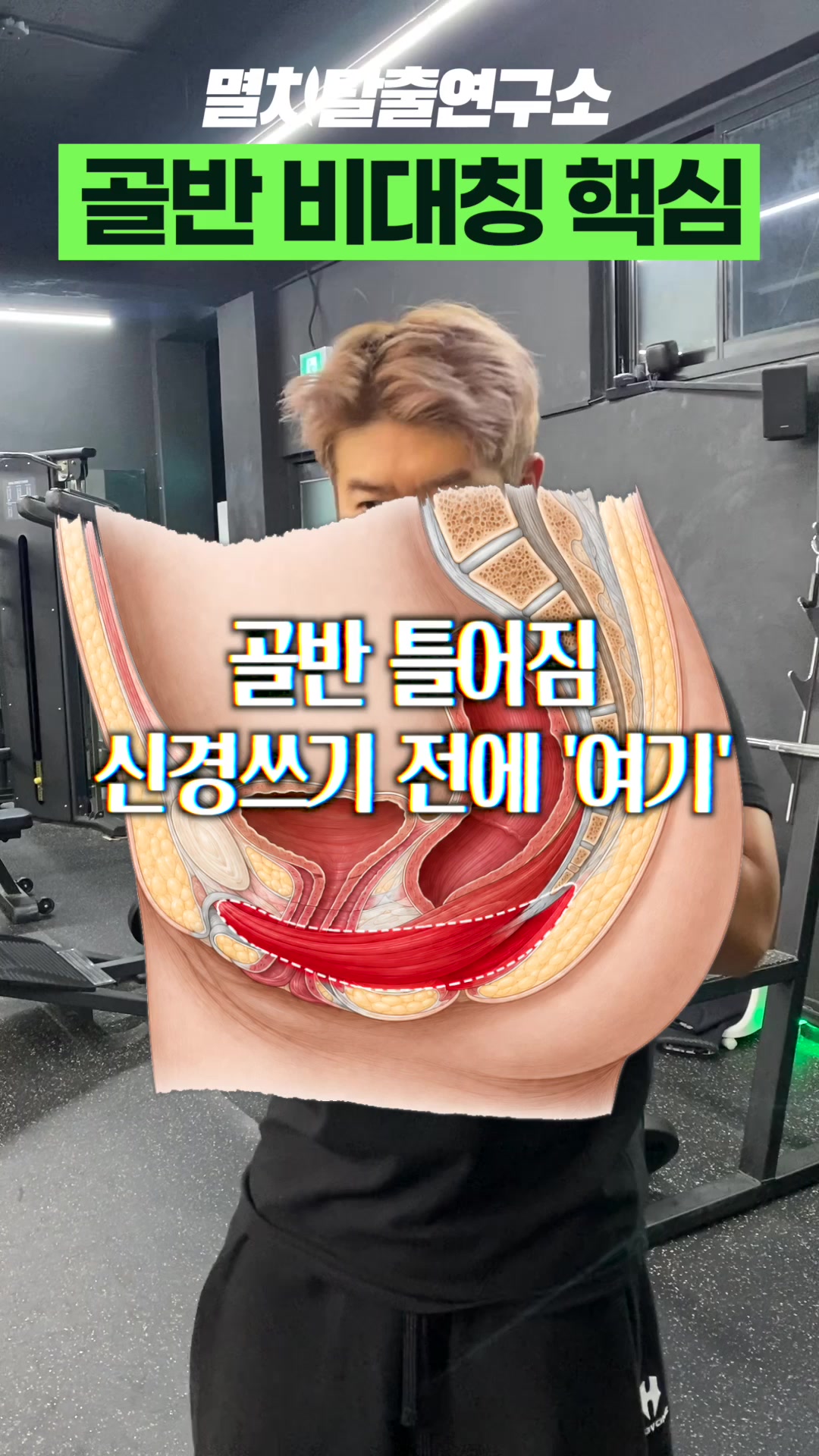 @멸치탈출연구소