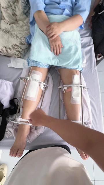 @K&eacute;o d&agrave;i ch&acirc;n TPHCM