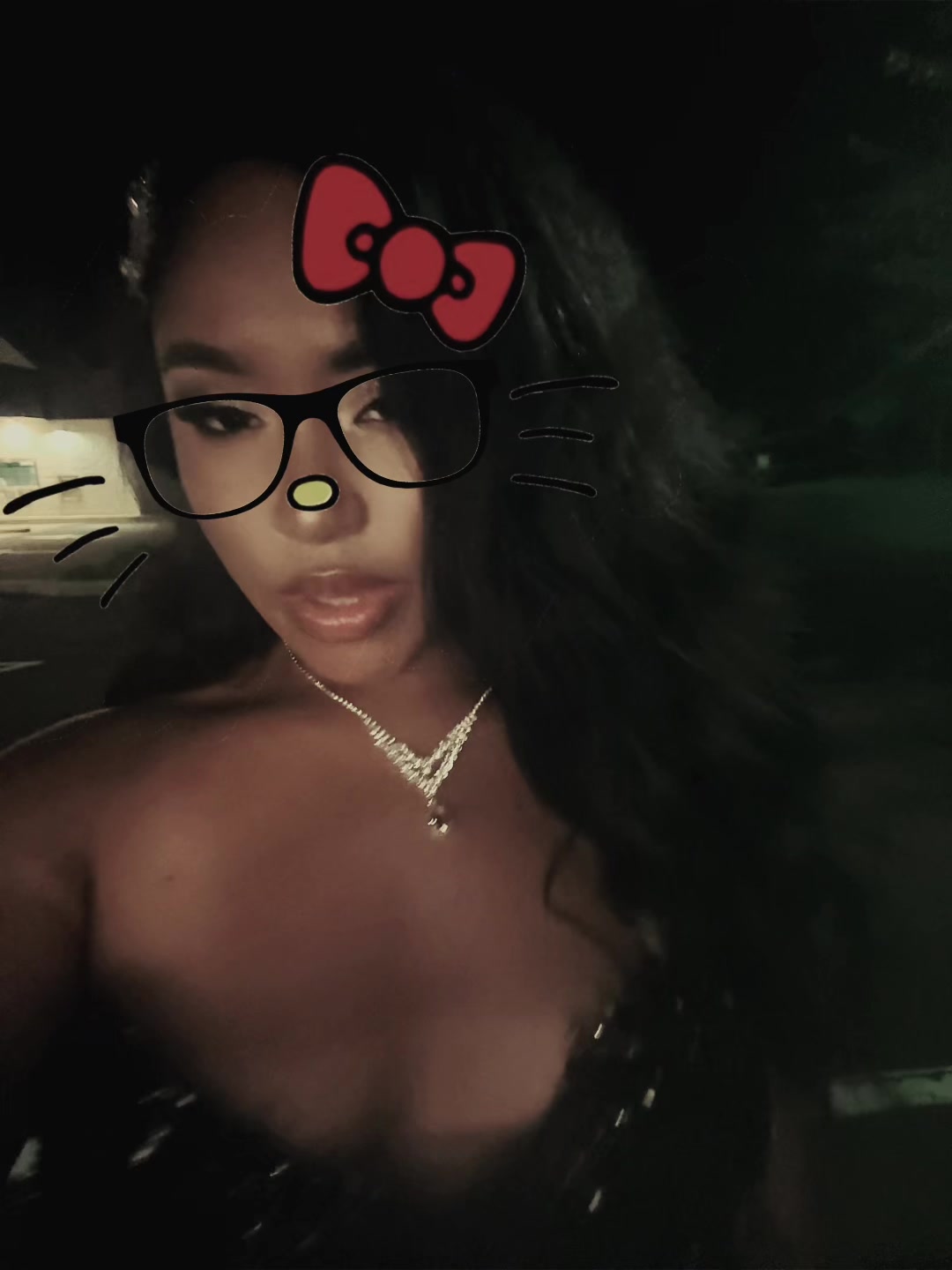 @MOLLI