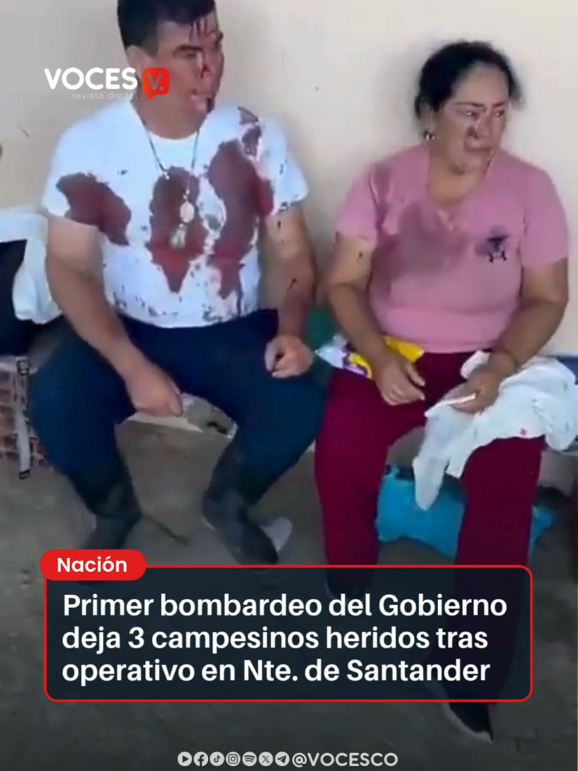 @Voces