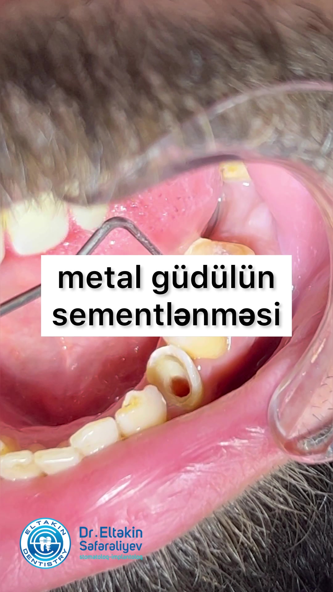 @eltakindentistry