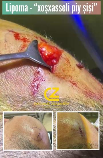 @Dr.Zamanov_Cemil