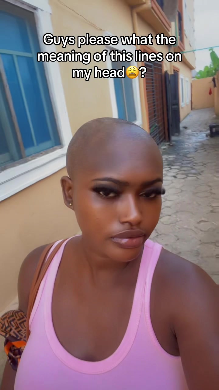 @Baldheadgirl