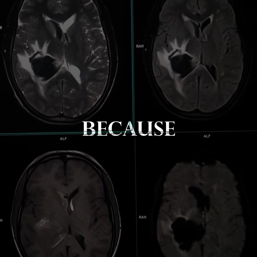 @MindTrace