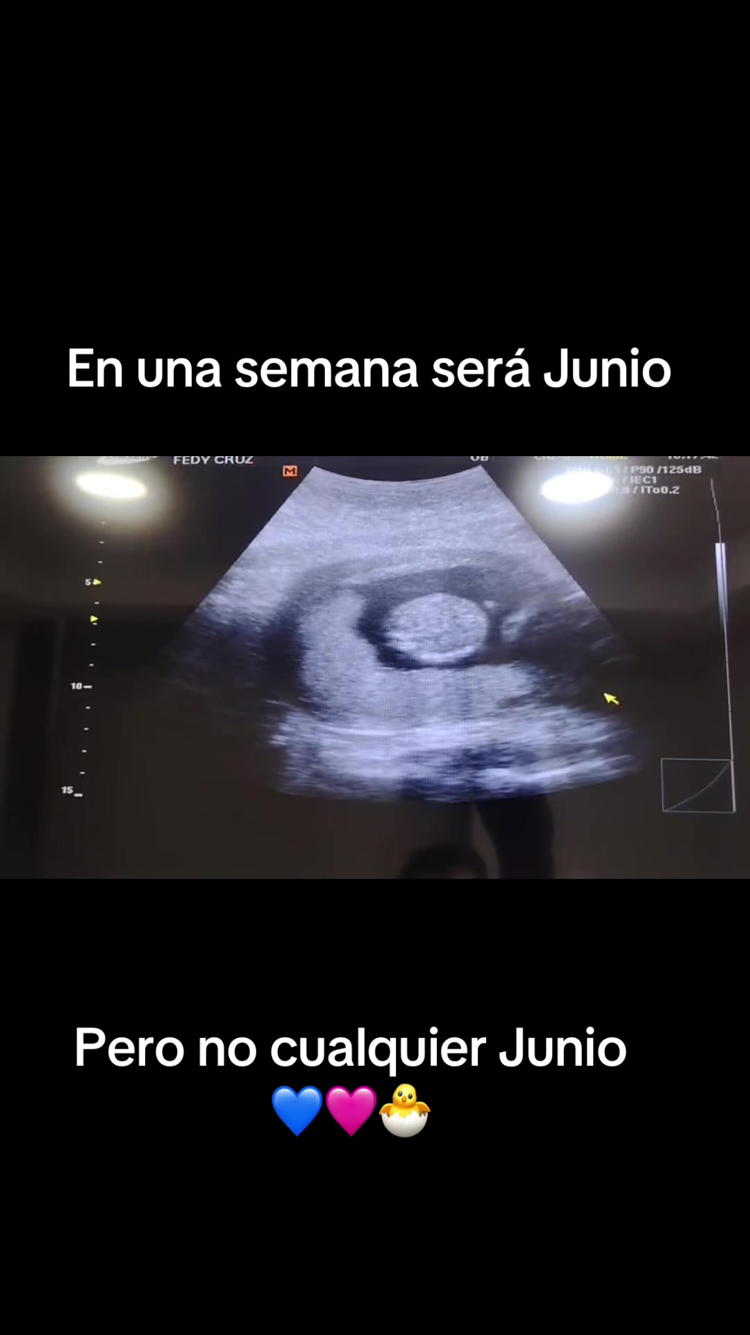 @Andrely
