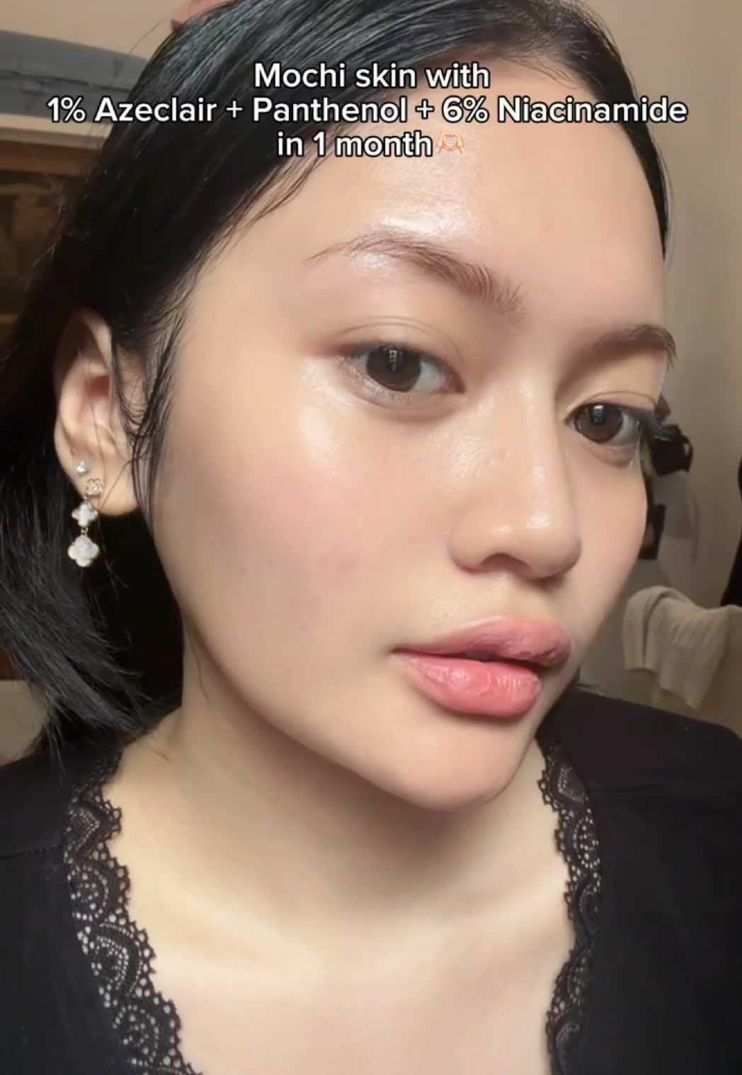 @๐ฎโก