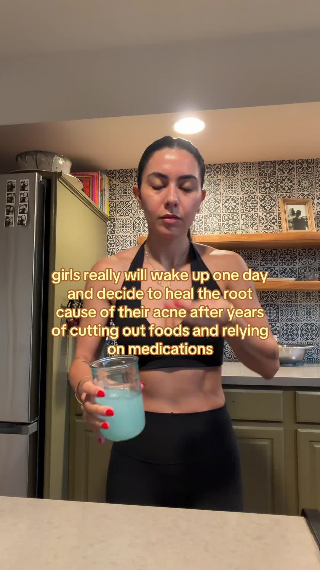 @Doctor Sheyda | Acne Expert
