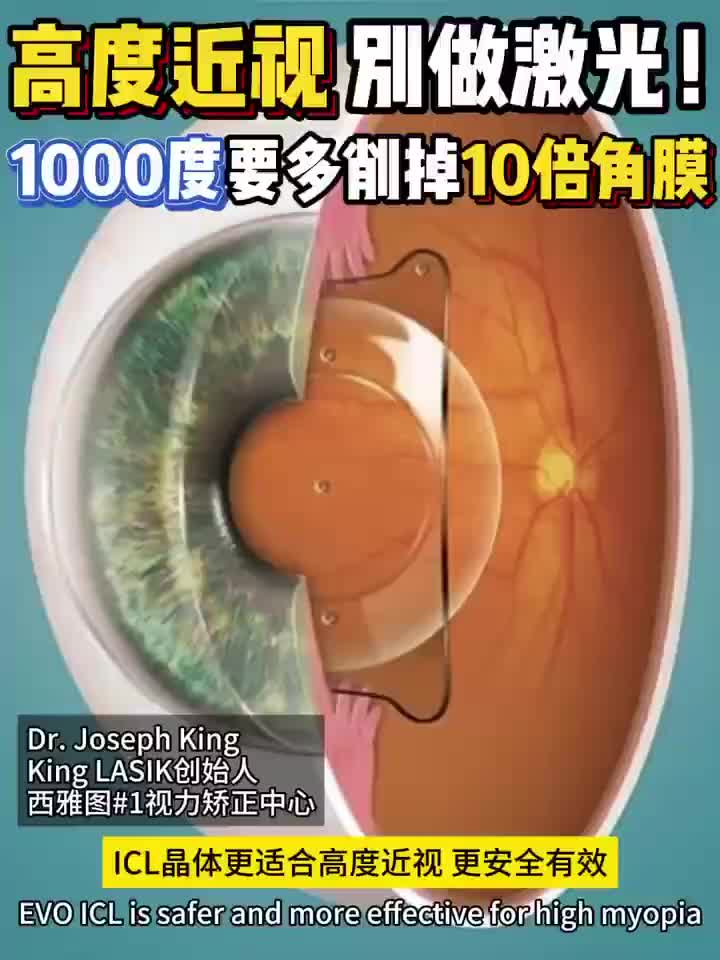 @🇺🇸西雅图/波特兰 King  Lasik 近视老花手术
