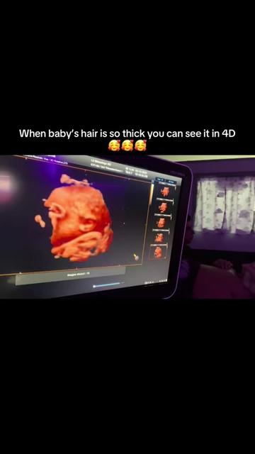 @lilblessings4dhd