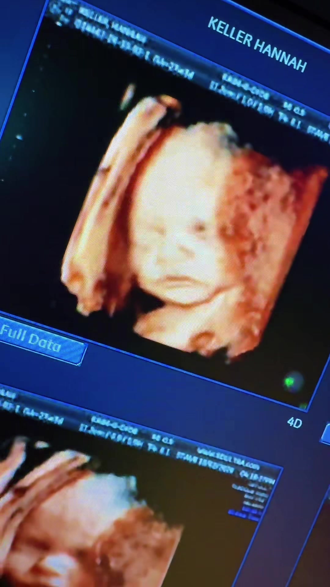 @PregnantSee Inc.