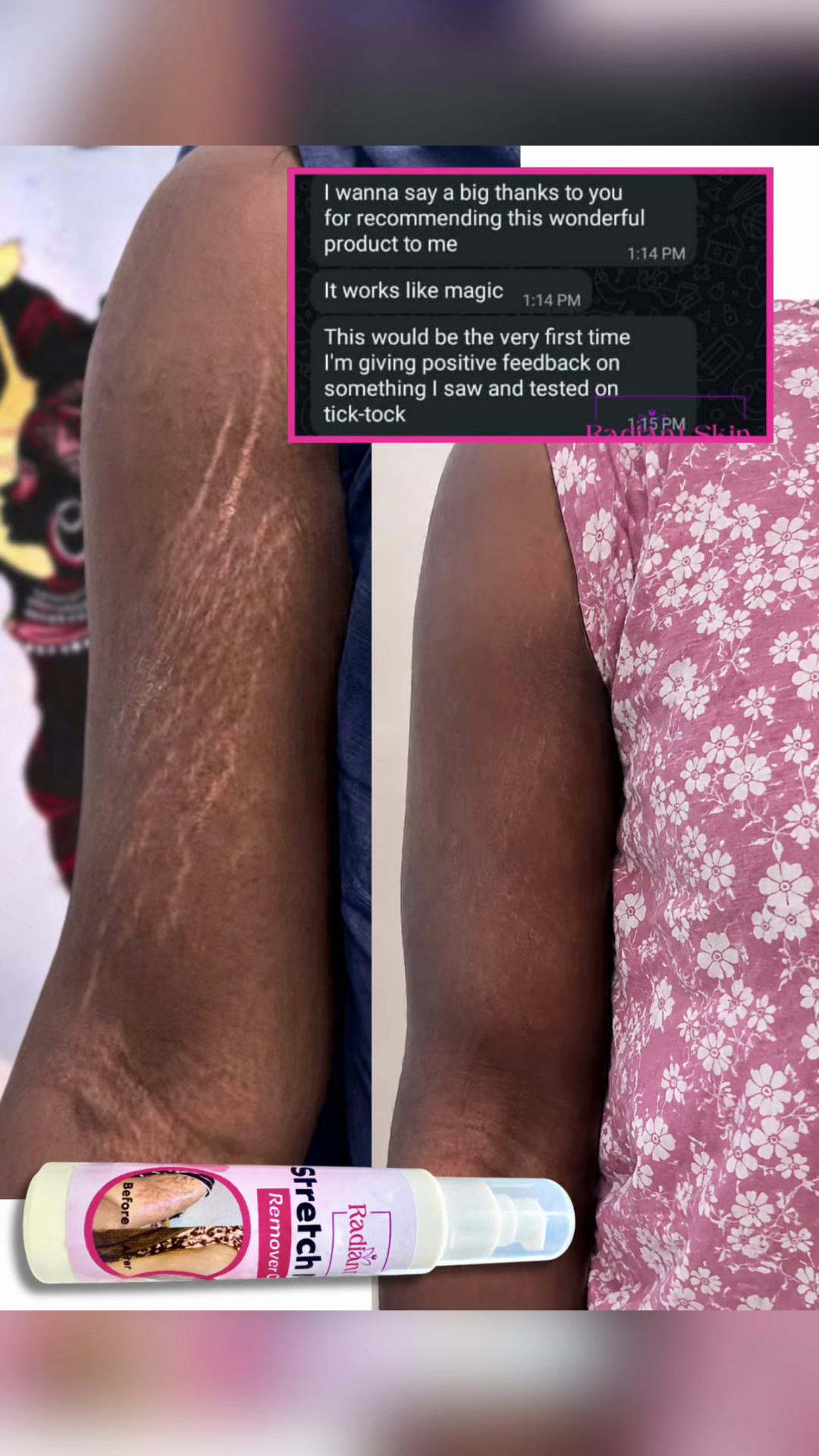@Radiant skin
