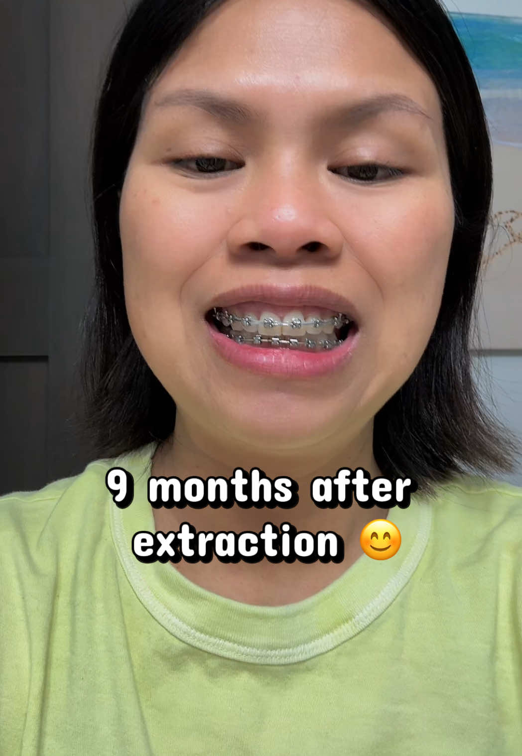 @mey-mey