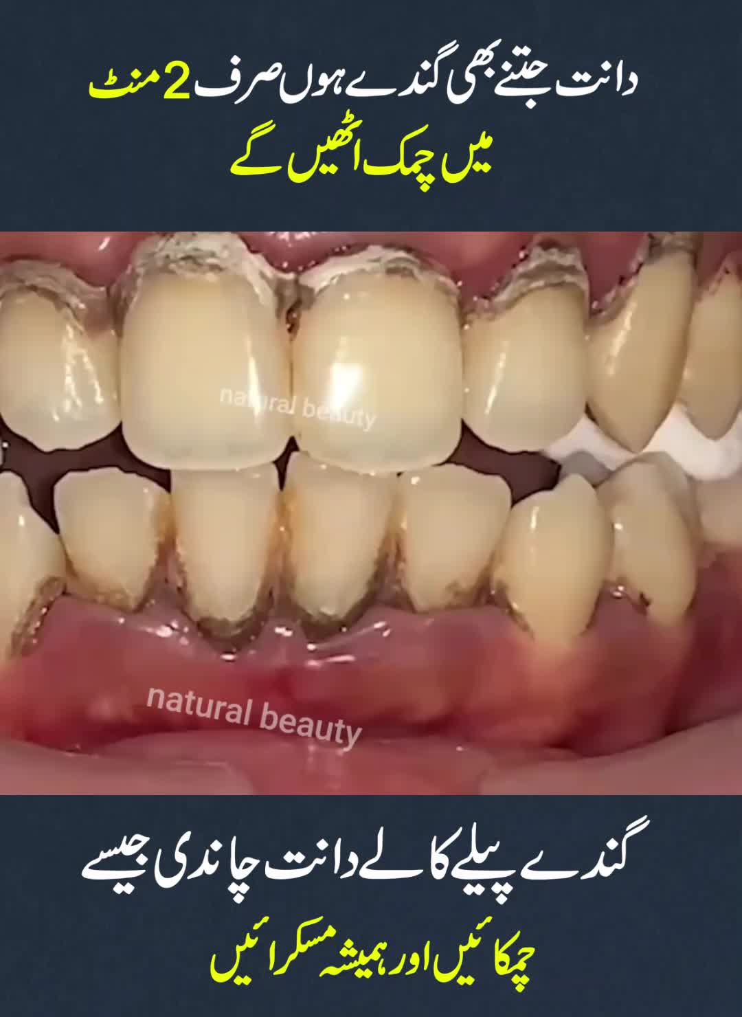 @Real Beauty