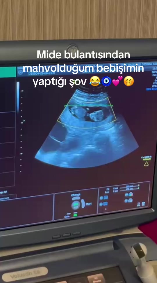 @GAMZE NUR CİHAN