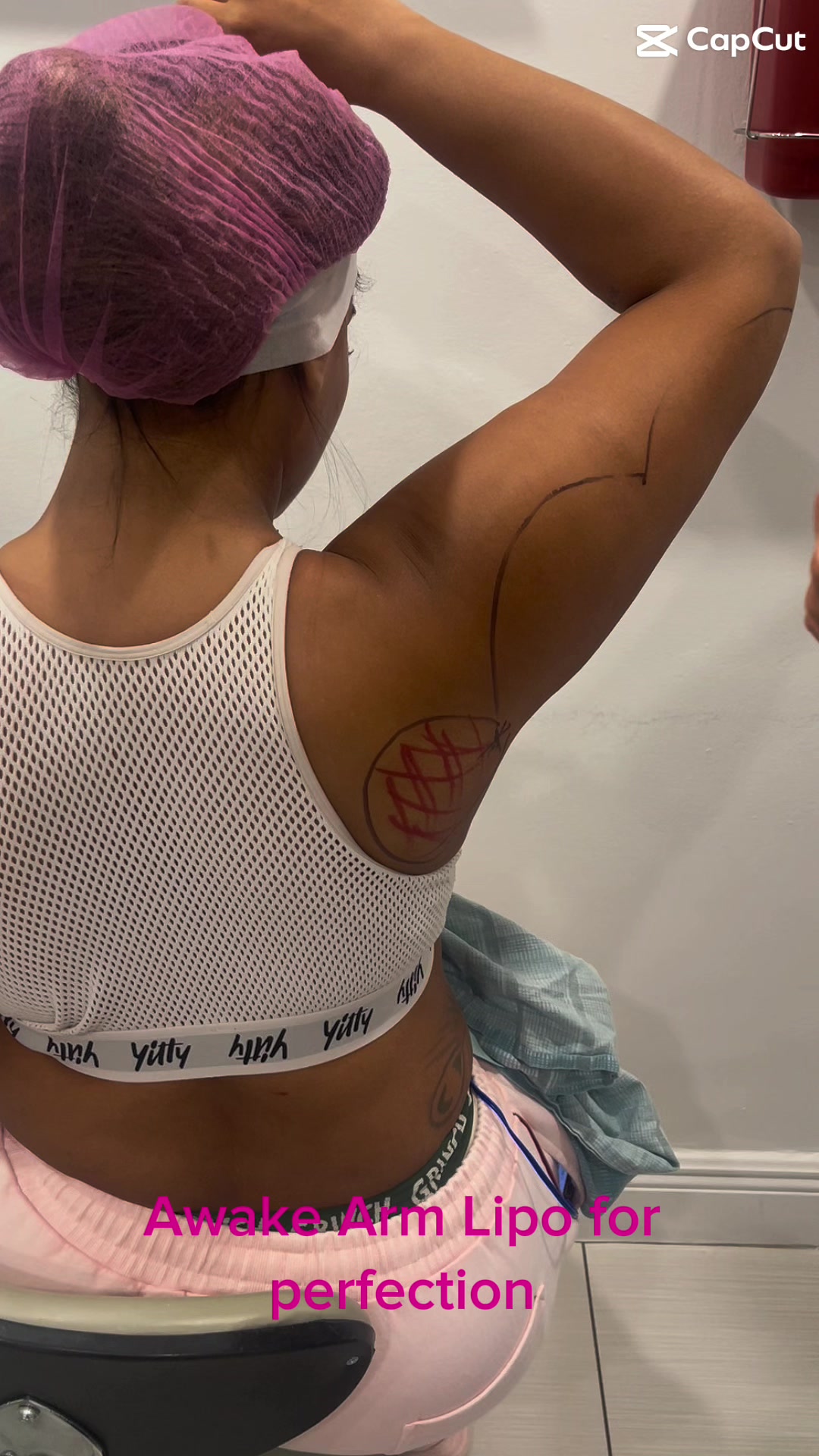 @BioAesthetic305