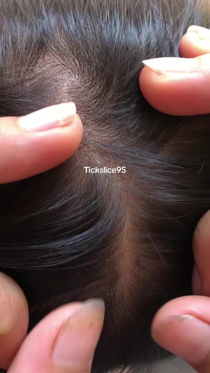 @Tickslice95