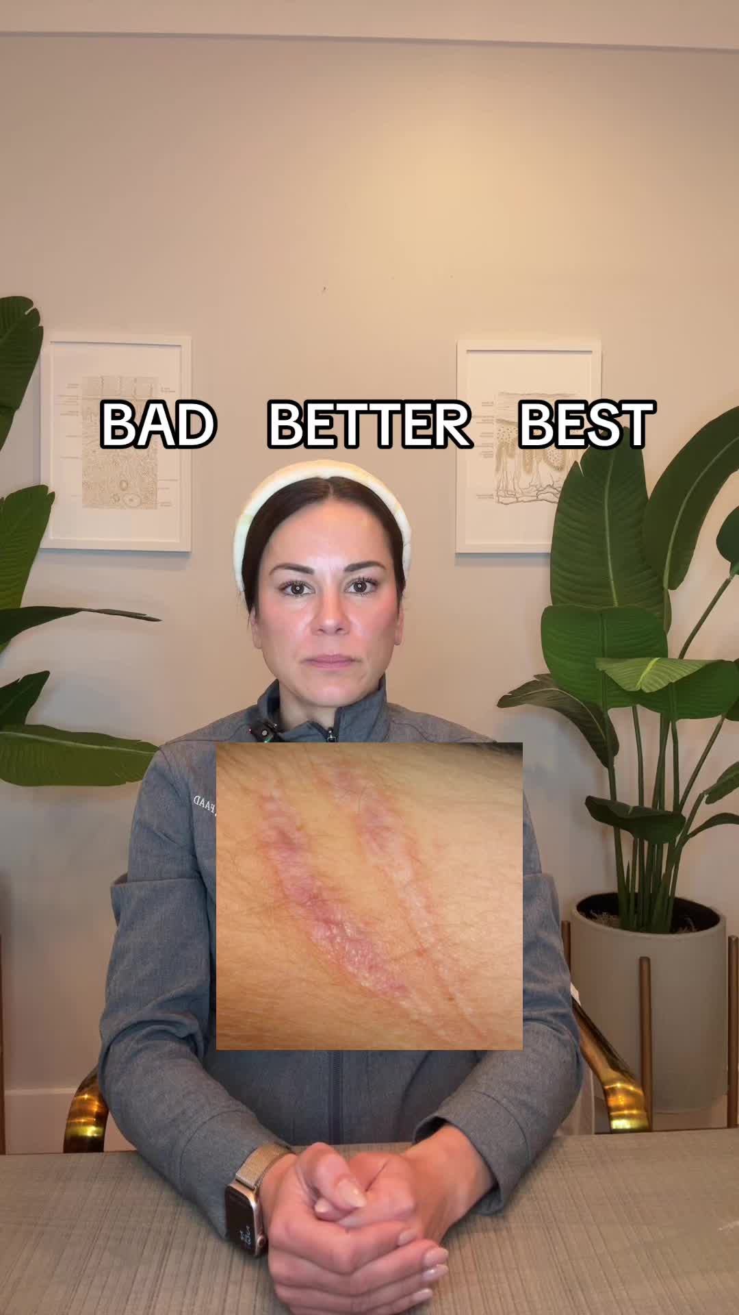 @Dermguru