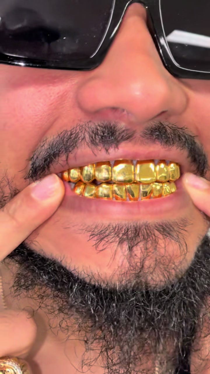 @GoldMoneyGrillz