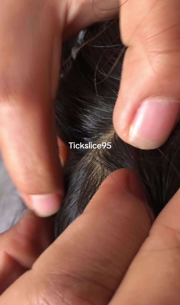 @Tickslice95