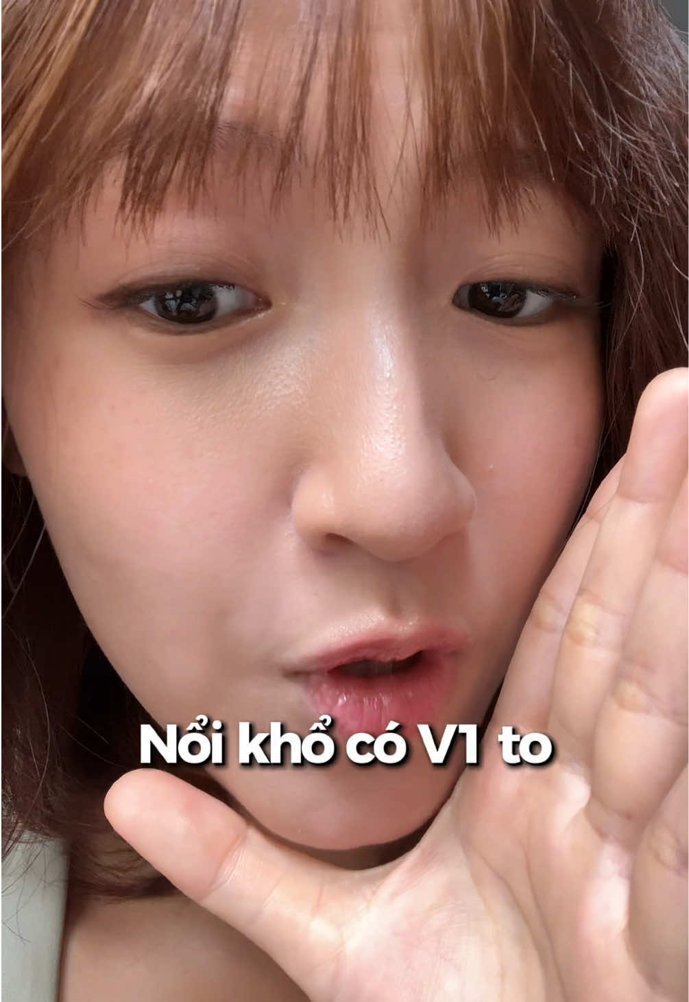 @Linh Xù