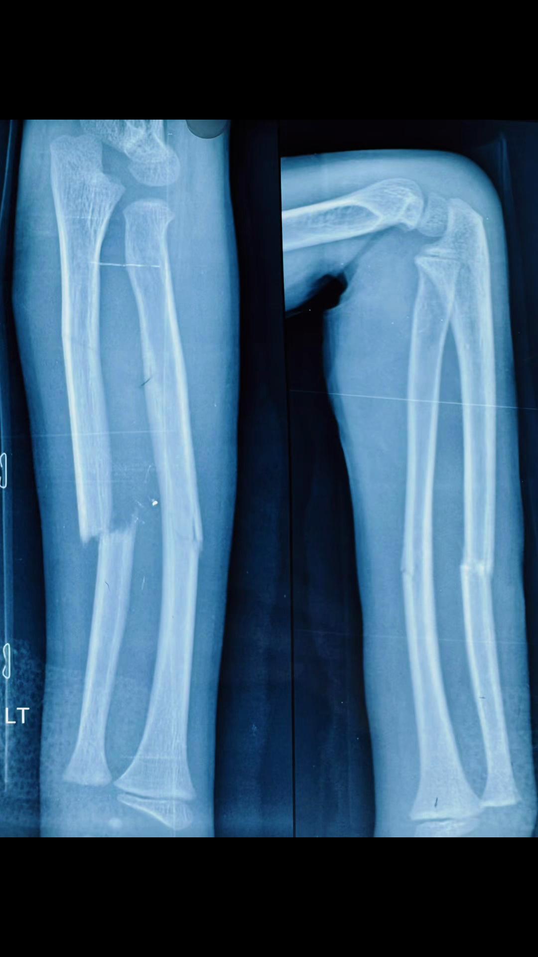 @Dr.Sanjay Gautam,Orthopedics🦴