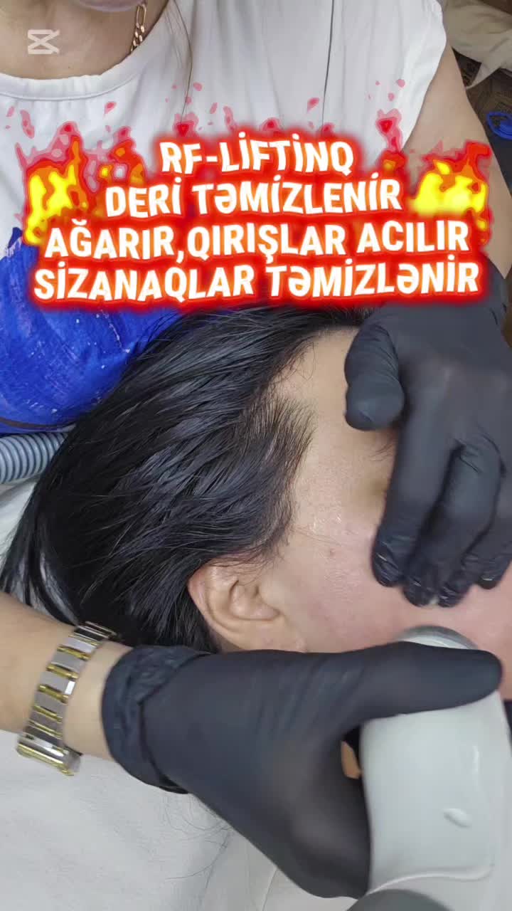 @ehmedli_kosmetoloq_lazeroloq