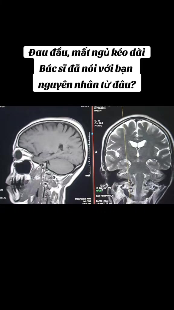 @Nguyễn Văn T&ugrave;ng
