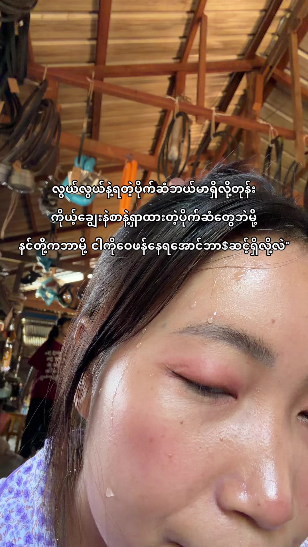 @Nan Yadanar Lin