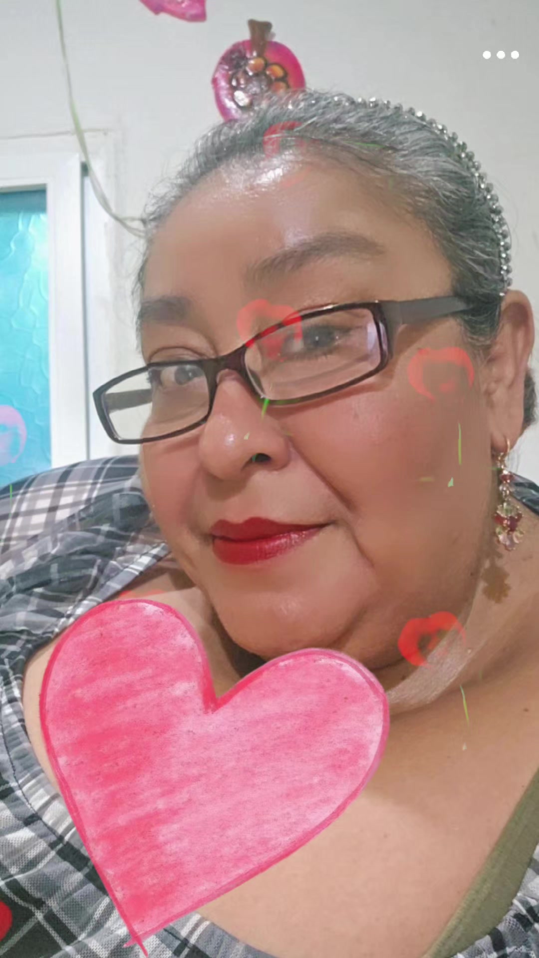 @Delmis molina