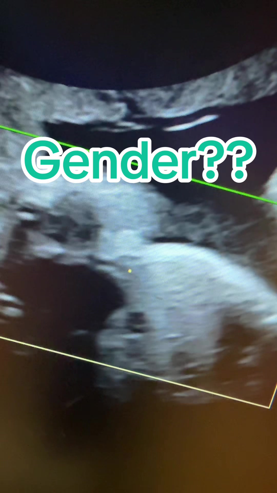 @PregnantSee Inc.