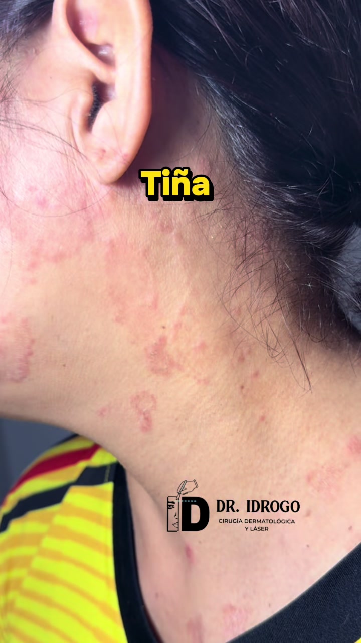 @dr.idrogodermatologo