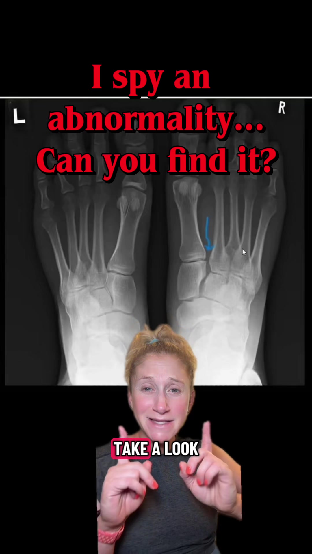 @Deanna, Physician-Assistant