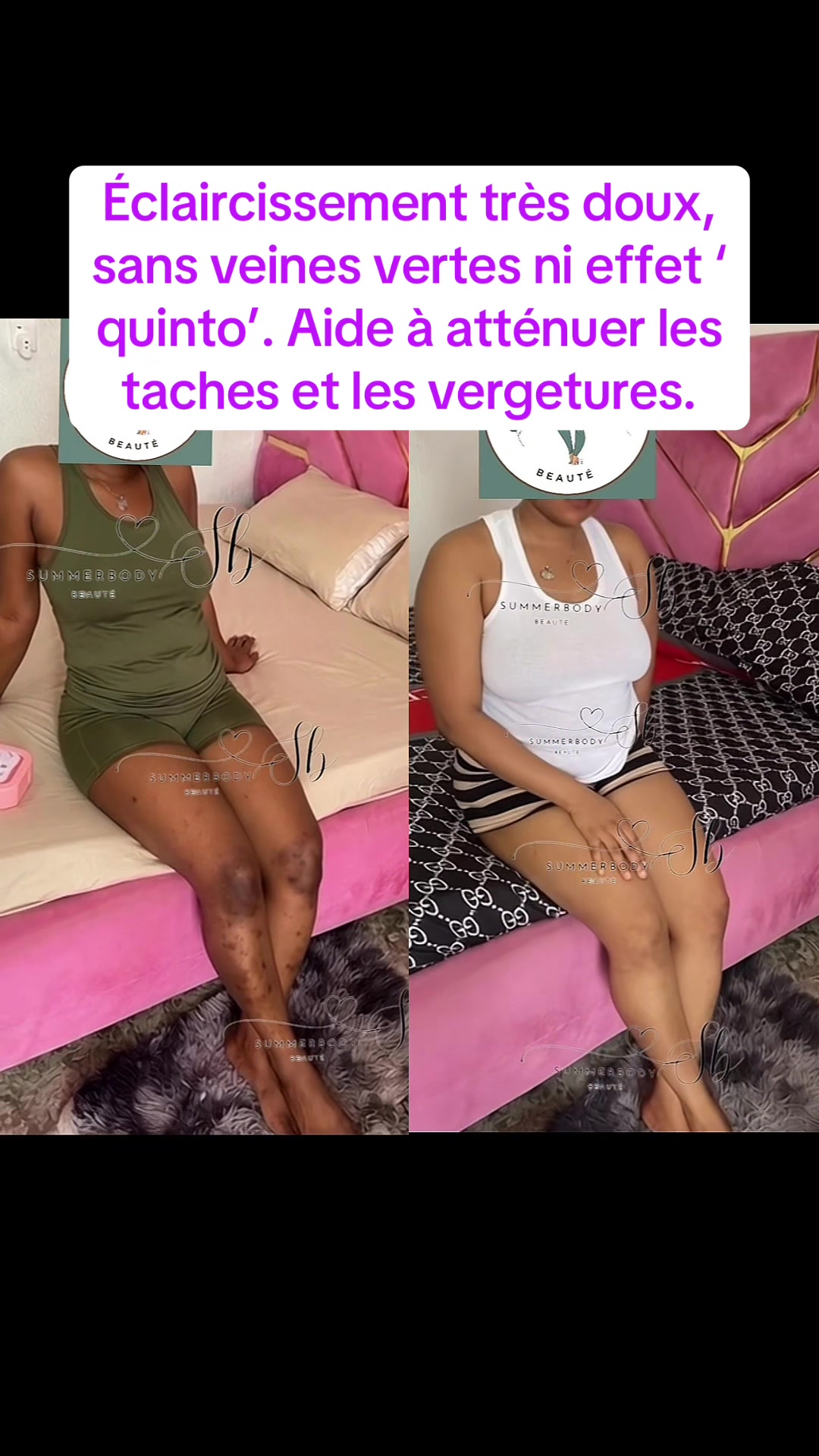 @summerbody