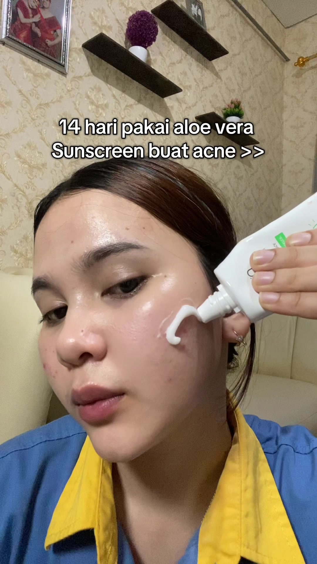 @Natha | Acne fighter