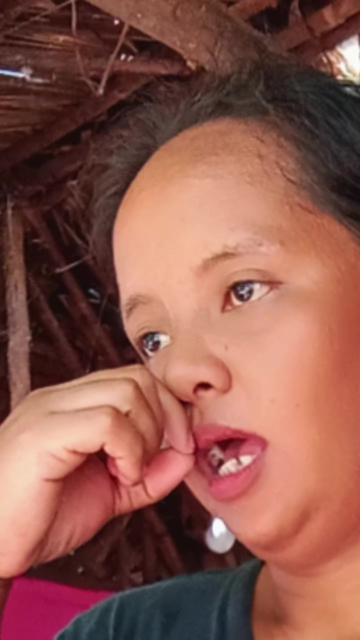 @bungal🤪✅