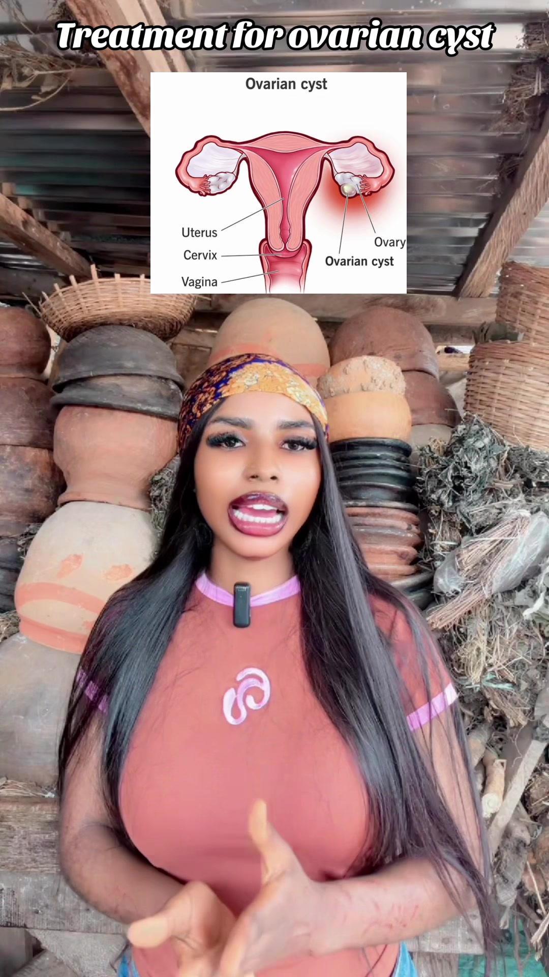 @GeNz_alagbo🐍🍯
