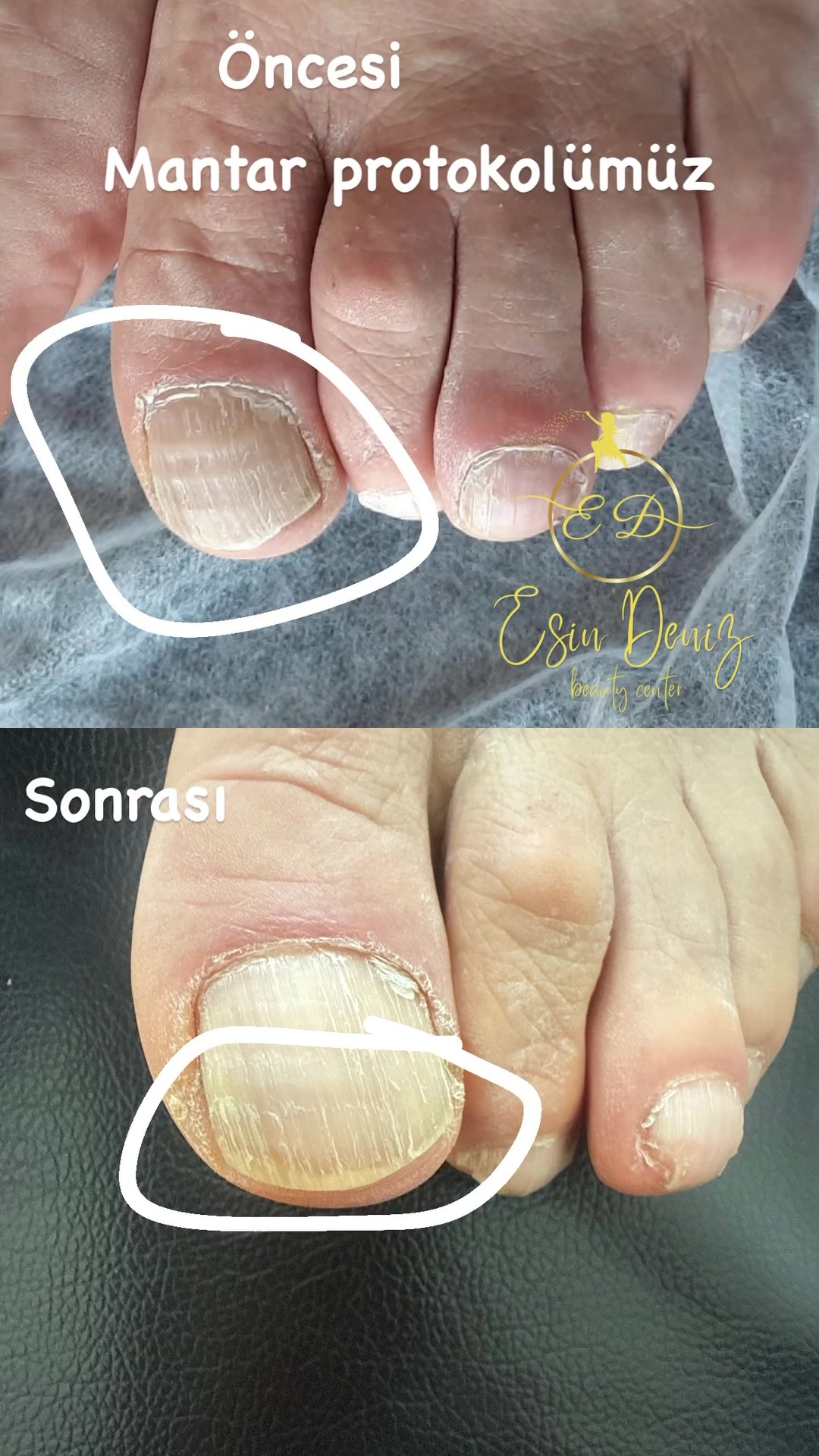 @Esin Deniz Beauty center