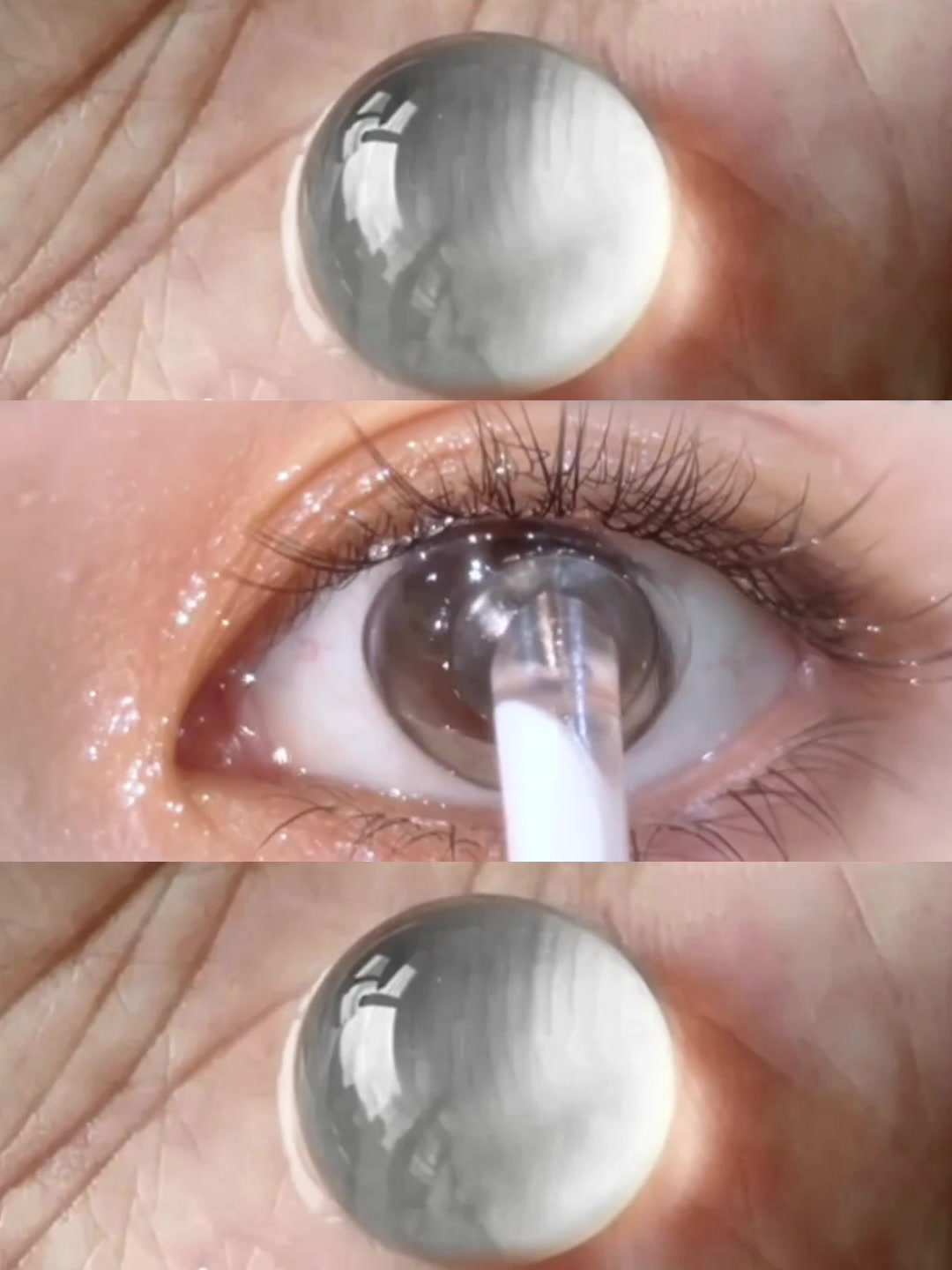 @4YOU Contact Lens