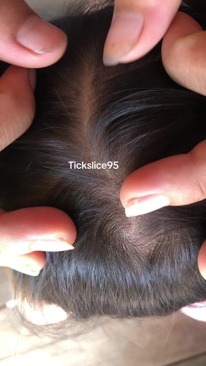 @Tickslice95
